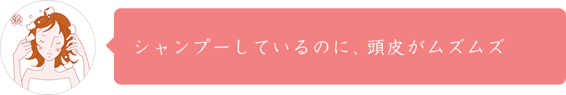 シャンプーしているのに、頭皮がムズムズ