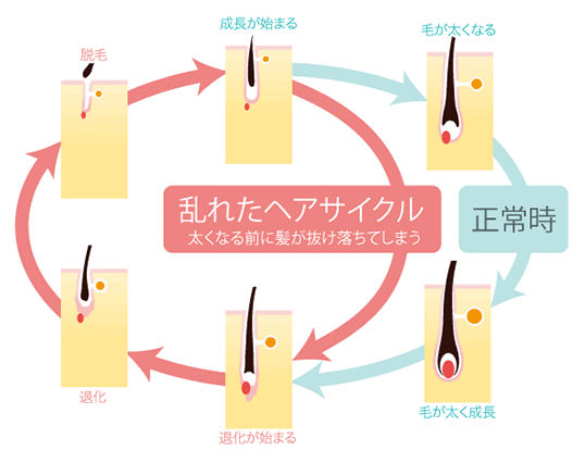 乱れたヘアサイクル太くなる前に髪が抜け落ちてしまう