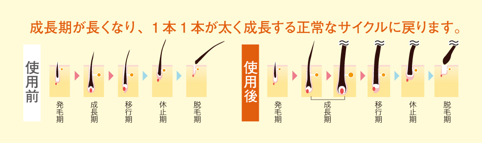 成長期が長くなり、1本1本が太く成長する正常なサイクルに戻ります。 使用前・使用後 発毛期 成長期 移行期 休止期 脱毛期
