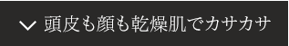 頭皮も顔も敏感肌でカサカサ